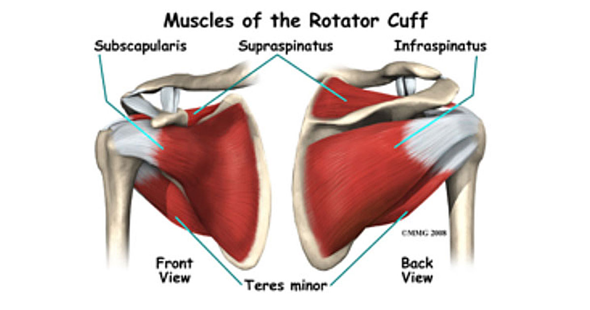 Rotator cuff tear - what should I do with it?