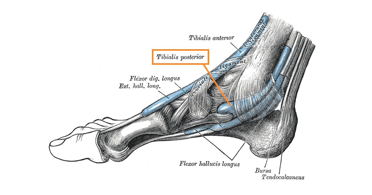 Posterior Tibial Tendonitis What Is It And How To Treat Posterior Tibial Tendonitis What Is It And How To Treat