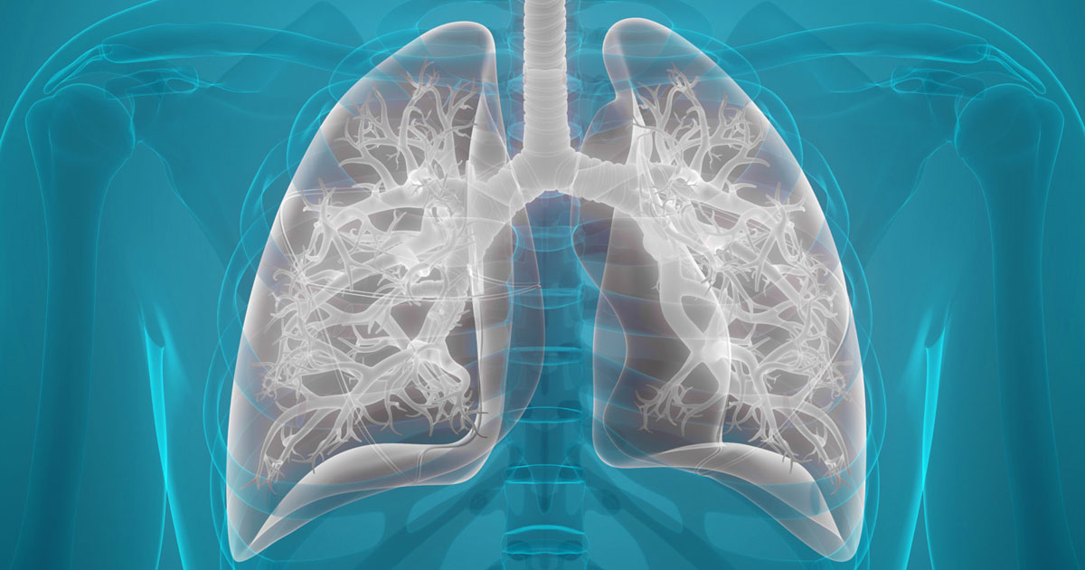 Long COVID, or Post COVID syndrome, are terms used to describe symptoms that last longer than 12 weeks following initial COVID-19 infection. A respiratory physiotherapist is recommended as a key part of rehabilitation.